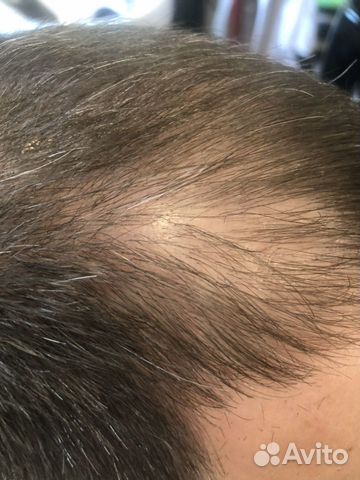 Набор от выпадения волос biological hairconcept