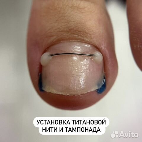 Подолог / Подология